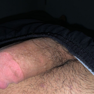 Rebeu31400