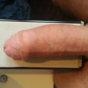 xphe