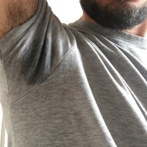 Prepuce