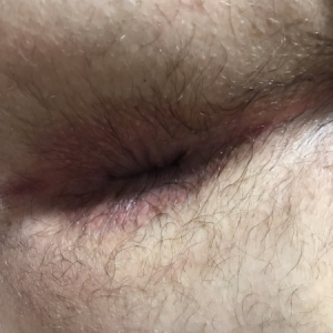 {member_username}